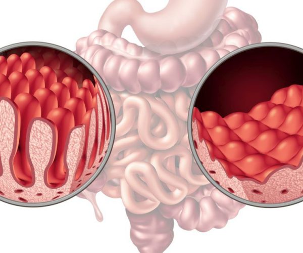 whatsapp image 2026 03 13 at 1.46.14 am (1)